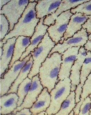 Cellule del connettivo fibroblasti cellule