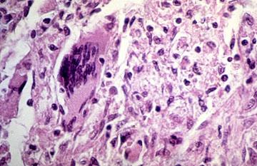 Cellule epiteliodi Numerose estroflessioni