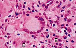 macrofagi e monociti
