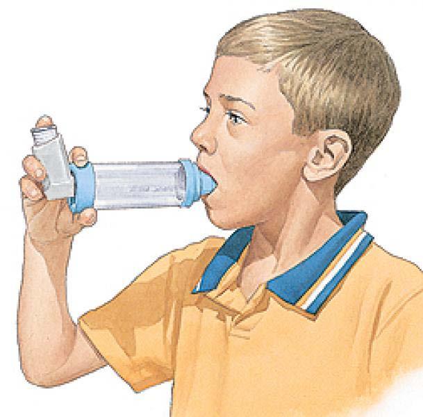 Utilizzi il corticosteroide inalatorio nel trattamento dell accesso acuto di asma?