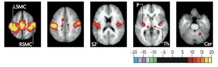Resting State Functional Connectivity Functional connectivity may refer to any study examining