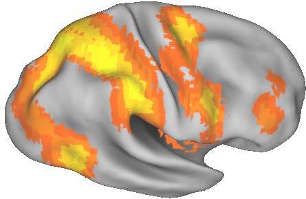 Task Attentivi Resting State Functional Connectivity SPL