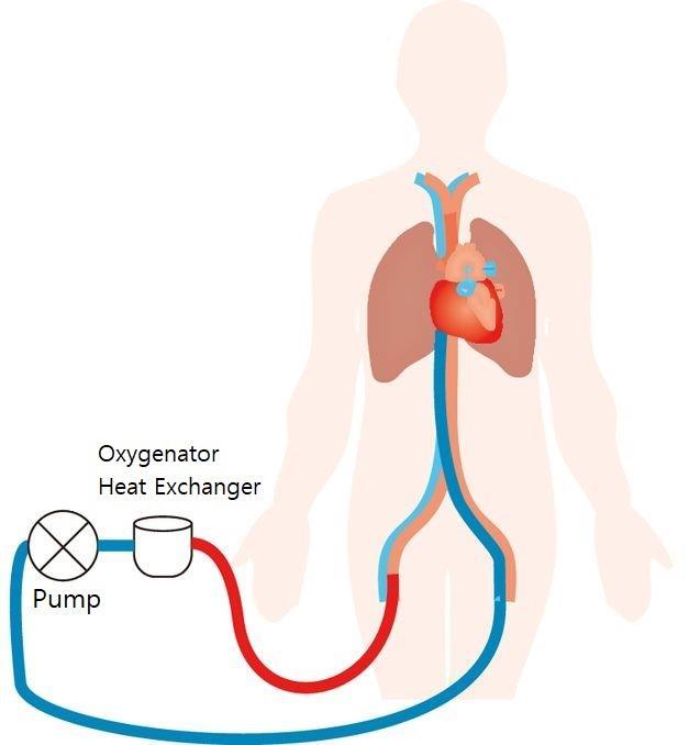 Tecniche di preservazione: Stato dell arte Tecniche di preservazione Totale assenza di afflusso di sangue Ischemia Calda: prima del