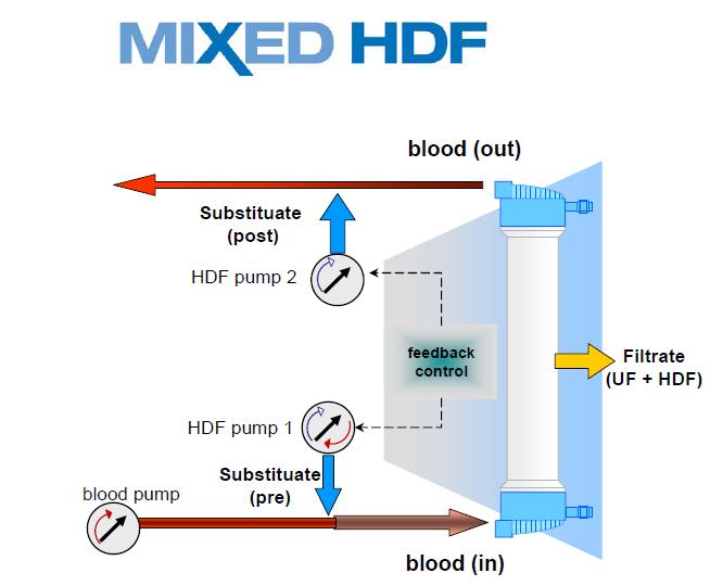 PRE-POST-MIXED: quale scelta?