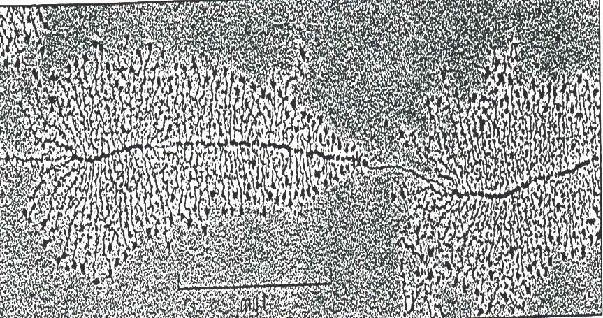 RNA ribosomiale: necessario per la sintesi proteica nell uomo ve ne sono 200 copie distribuite su 5 cromosomi.