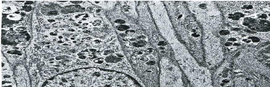 Celule di Schwann con processi