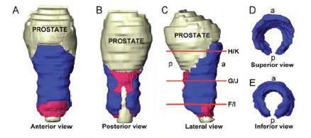 Meccanismi di continenza urinaria Sfintere uretrale esterno (SUE): (BLU) localizzato distalmente alla prostata, a livello dell uretra membranosa, è il secondo sfintere che controlla il flusso