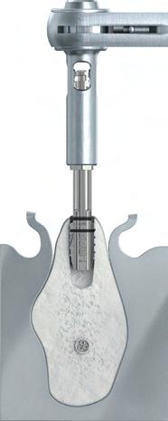 La maschiatura manuale del foro viene eseguita con l'adattatore per maschiatore e la chiave dinamometrica bloccata.