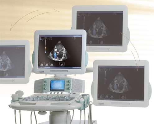 MyLab GOLD Platform 2 Elevata Qualità d'immagine: un nuovo standard di immagini di ottima qualità in tutte le modalità e in una vasta gamma di applicazioni, incluse cardiologia standard e avanzata e