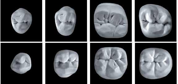 Design particolare delle superfici occlusali con spazi liberi fisiologici Sulle superfici occlusali dei denti