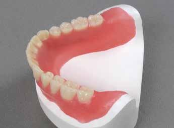 Q 3 Pack contiene singoli denti posteriori, che possono essere adattati individualmente nella loro posizione.