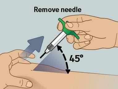 10) Estrarre l ago dalla pelle Estrarre l ago Estrarre l ago dalla pelle con lo stesso angolo utilizzato per l inserimento (45