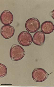 Polline di Quercus (quercia) Tri-zono-colpato, isopolare, oblato o oblato-sferoidale, 20-30 µm di diametro.