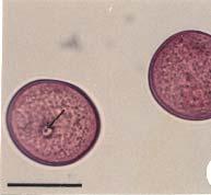 Il poro, spesso circolare, è circondato da annulus e