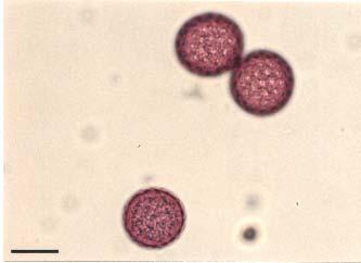 Polline di Chenopodiaceae Poli-panto-porato (40-70 pori),