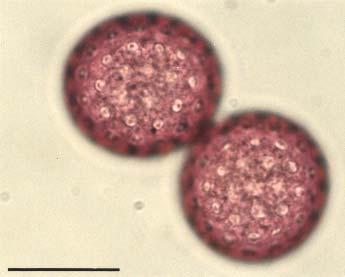 Esina finemente granulata con microechine, più spessa nella