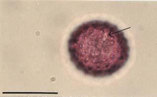 Polline di Compositae (Ambrosia)(