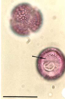 Polline di Salix (Salicaceae) Tri-zono-colporato, isopolare, oblato-sferoidale, 16-25 µm.