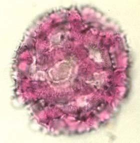 Polline di Taraxacum (Compositae Liguliflorae) Tri-zono-porato (o tri-zono