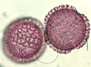 Polline di Ligustrum (Oleaceae) Trizonocolporato, isopolare, oblato-sferoidale, 22-30 µm. Colpi fusiformi, lunghi, con apici acuti.