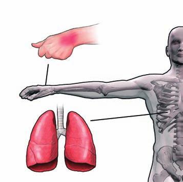 Il rischio elettrico in cantiere Conseguenze di un contatto con una parte elettrica Il passaggio di corrente elettrica attraverso il corpo umano può produrre vari effetti, consistenti generalmente in