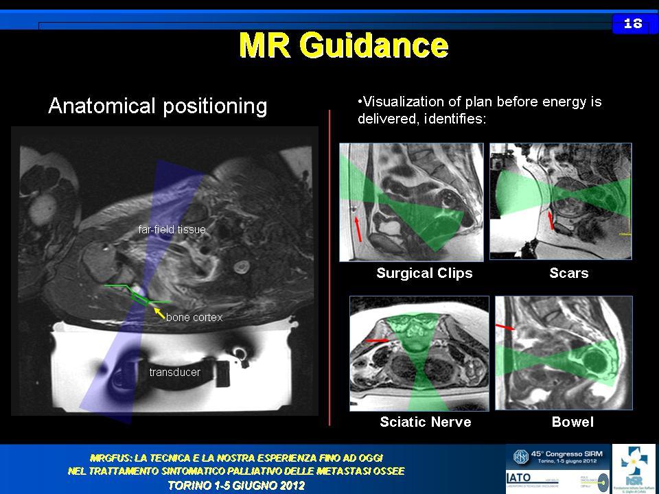 slide 19