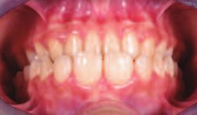 Elastodonzia: un nuovo approccio in ortodonzia, protesi e conservativa Dr.