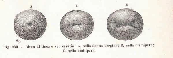 Il canale endocervicale è rivestito nella maggior parte della sua estensione da epitelio cilindrico muco secernente.