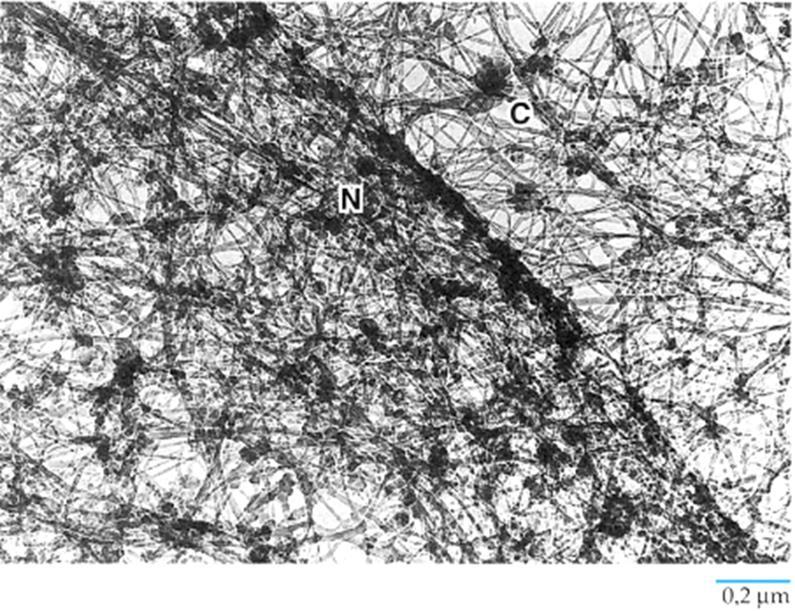 Nucleo e matrice nucleare Il materiale contenuto all interno dell involucro nucleare tranne la cromatina ed