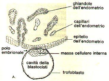 Impianto