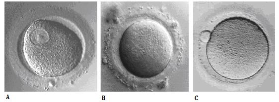 IntraCytoplasmic Sperm