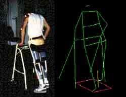 Metodi Studio cinematico 3D Protocollo total body Maschio, 22 anni, paraplegia completa, lesione spinale T5 Utente RGO
