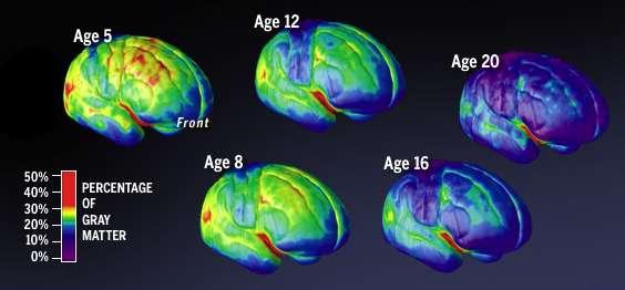 2 - Addiction, un approccio neurobiologico 2b - IL cervello
