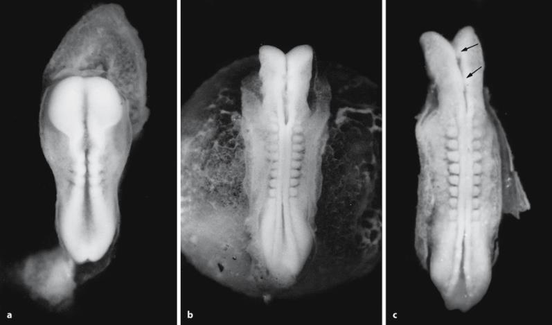 Neurulation in human embryos: a a five-somite embryo at Carnegie stage 10;b a ten-somite embryo at Carnegie stage 10; c a ten-somite embryo at Carnegie stage 10 in which the neural tube has closed at