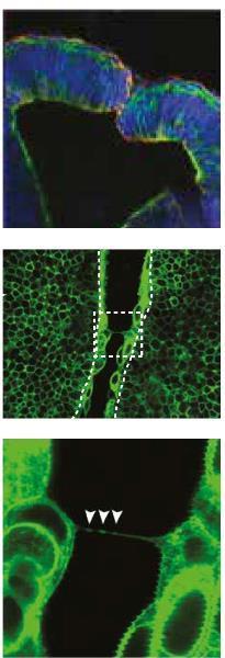 ectoderma non