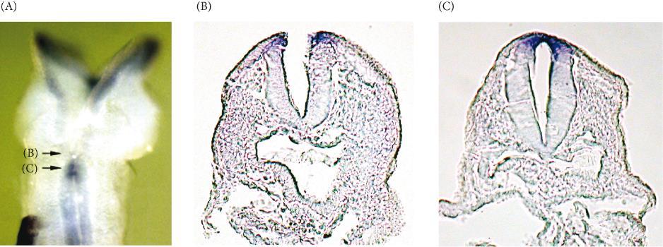 Acido folico è efficace nel prevenire difetti di chiusura del tubo neurale Terapia