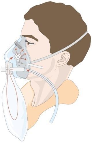 Intossicazioni da monossido Trattamento Autoprotezione - allertare i VV.FF.