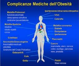 SOVRAPPESO E OBESITA Il sovrappeso e l obesità sono condizioni caratterizzate da un eccessivo accumulo di tessuto adiposo (grasso).