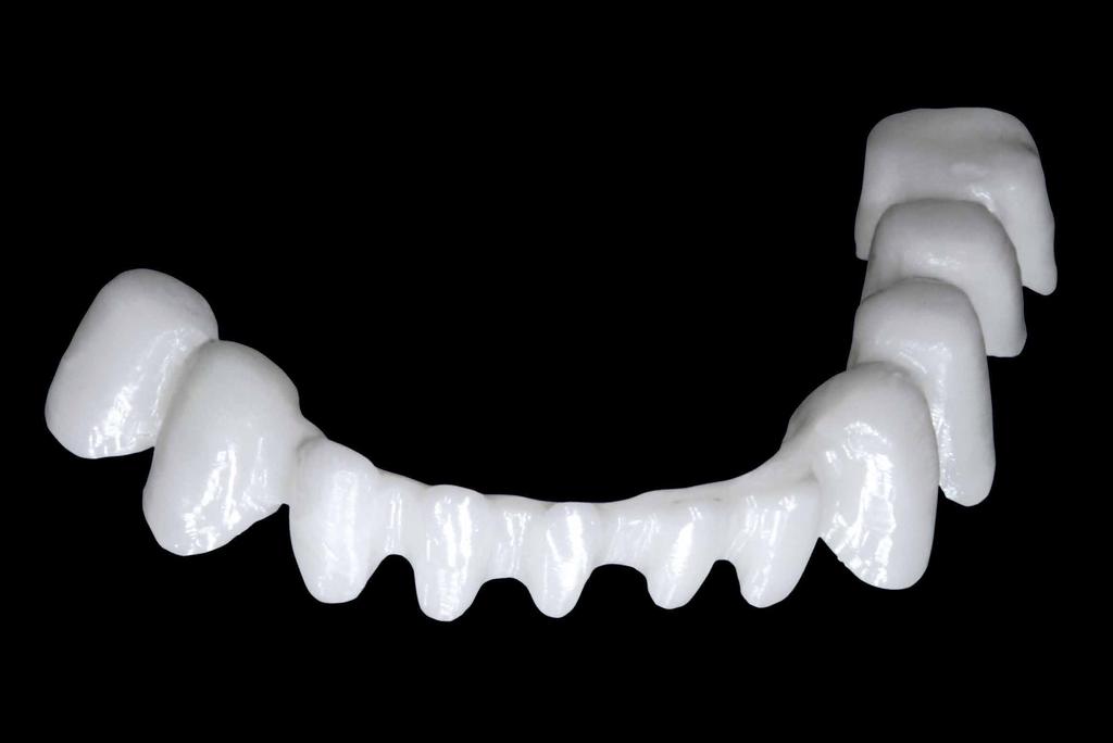 Un sistema efficace e vantaggioso Massima estetica con il minimo dispendio di tempo Vintage ZR permette una tecnica di stratificazione semplice, simile alla struttura dentina-smalto dei denti