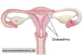 TUMORI DELL ENDOMETRIO Si manifesta più frequentemente in post menopausa, ed è raro prima dei 40 aa E la neoplasia ginecologica più