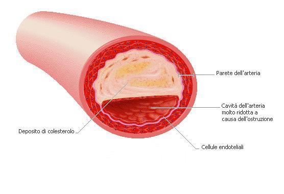 I vasi sanguigni Il sangue, spinto dal cuore, circola nell organismo racchiuso in una serie di canali detti vasi sanguigni. Essi si dividono in: arterie, vene e capillari.