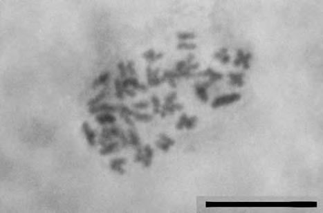 Il nostro conteggio concorda con quanto noto per il materiale greco (KIRSCHNER, ŠTEPÁNEK, 1998). Fig. 4 Taraxacum olivaceum, 2n = 32. Barra: 10 µm. Fig. 3 Taraxacum noterophilum Kirschner, Sonck & Stepanek, 2n = 24.