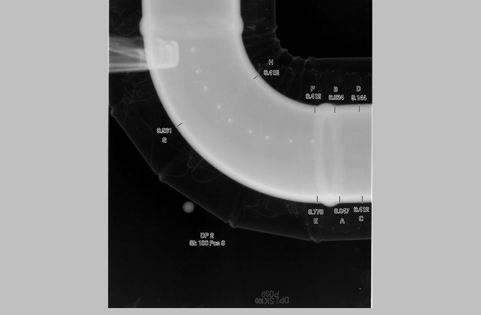 Sistema digitale Carestream ACR 2000i Kodak ACR-2000i La Radiografia Digitale utilizza al posto delle pellicola radiografica una lastra foto-sensibile al fosforo.