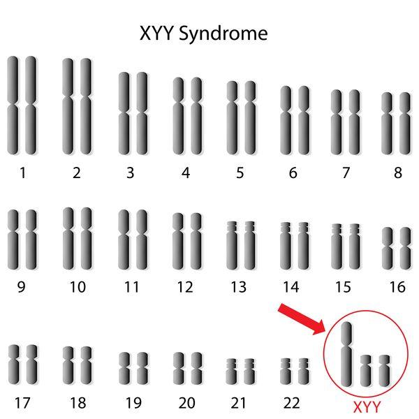 quale è presente, oltre ai cromosomi X e Y tipici del