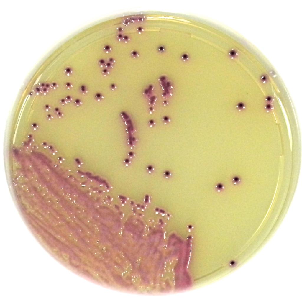ESBL in Enterobacteriaceae directly from clinical specimens.