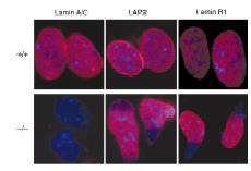 fenotipi Nuclei di fibroblasti colorati con