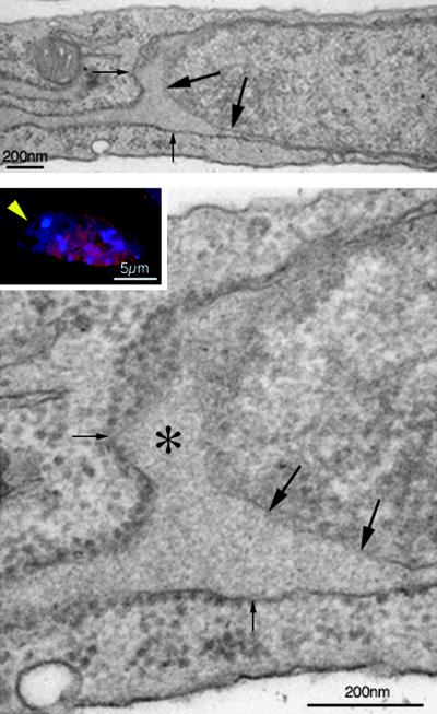 Cellule di topo con mutazioni della Lamina A/C presentano erniazioni della membrana nucleare nelle quali regioni della membrana