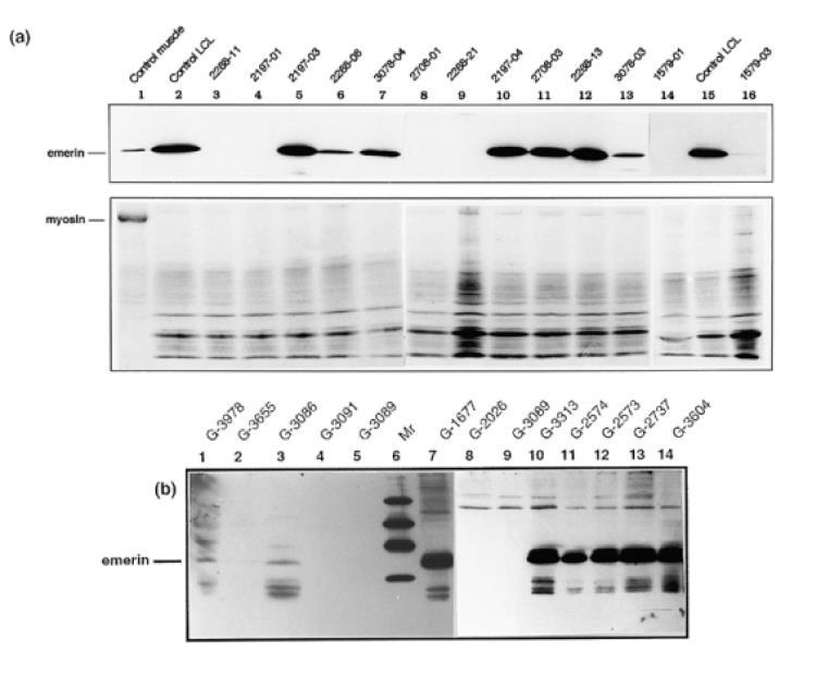 Western blotting di emerina in