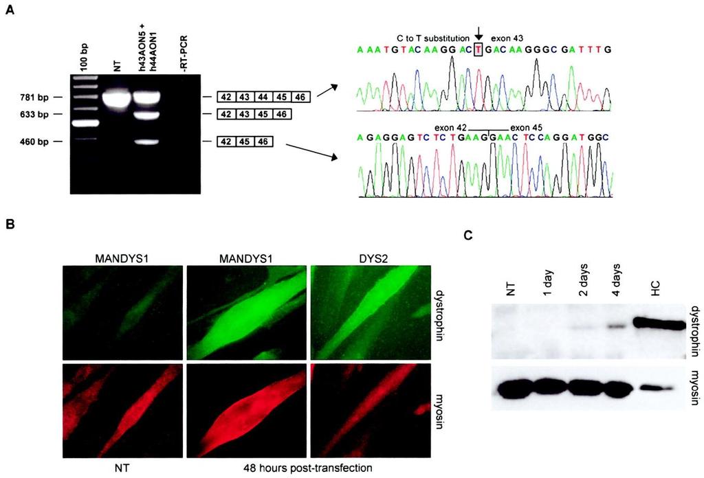 Antisense-Induced Multiexon Skipping for Duchenne Muscular