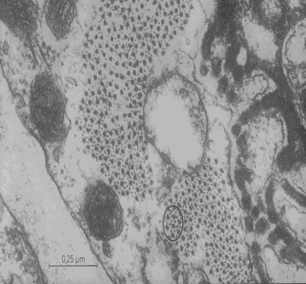 I filamenti di miosina sono identificabili soprattutto nelle cellule in contrazione (lo spessore è simile a